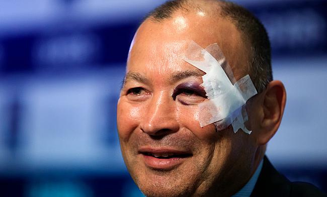 Eddie Jones sported a facial wound at the RBS 6 Nations launch last week
