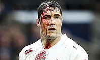 Brad Barritt showing just how bloody the sport can get