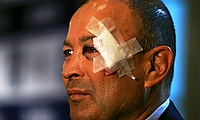 A fall was attributed to Eddie Jones showing up to the Six Nations launch with a wound to his face